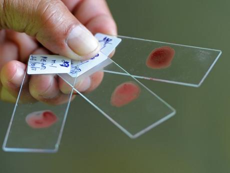 sangue infetto sangue infetto
